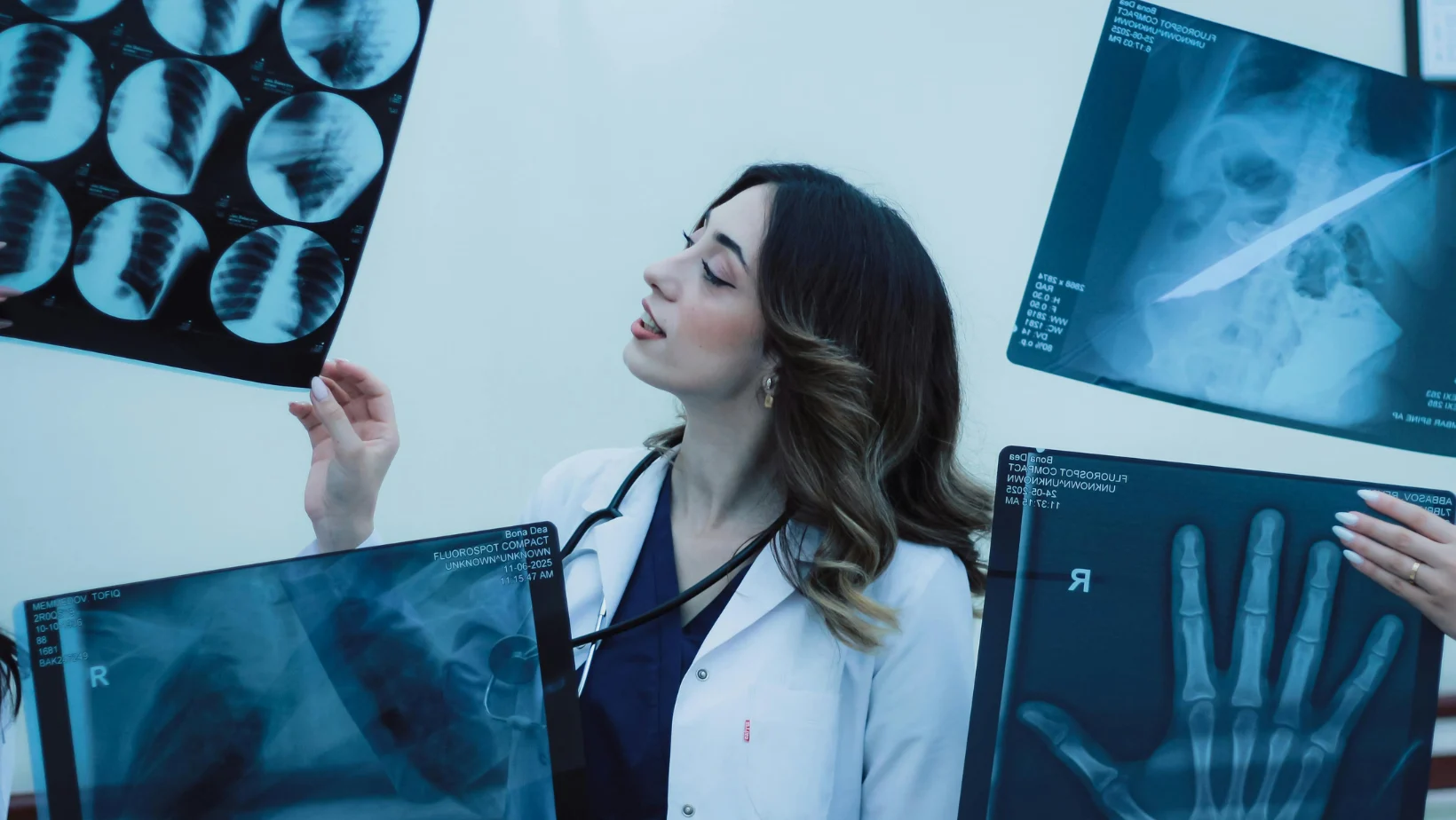 A female doctor in a white lab coat and stethoscope examining multiple X-ray films, including chest and hand scans, held up against a bright background.